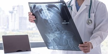 Kanser Önlenebilir Bir Hastalıktır!