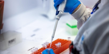 Gana’da bu yıl ilk kez M çiçeği vakası görüldü